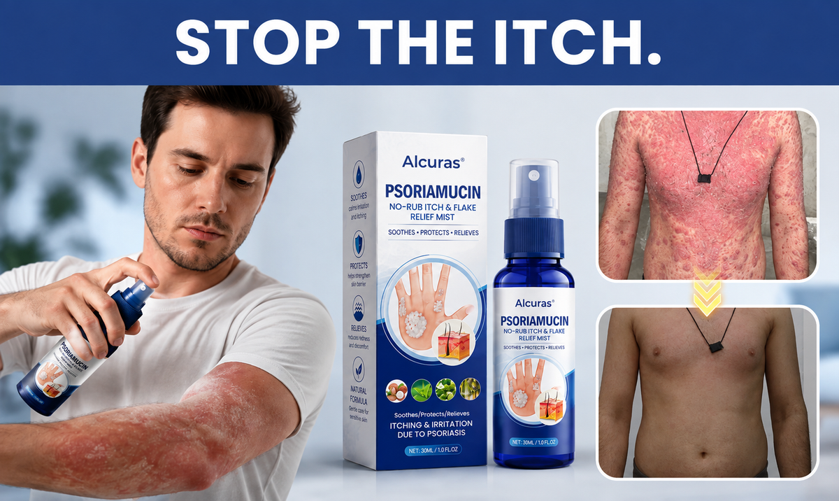 Alcuras® PsoriaMucin No-Rub Itch & Flake Relief Mist