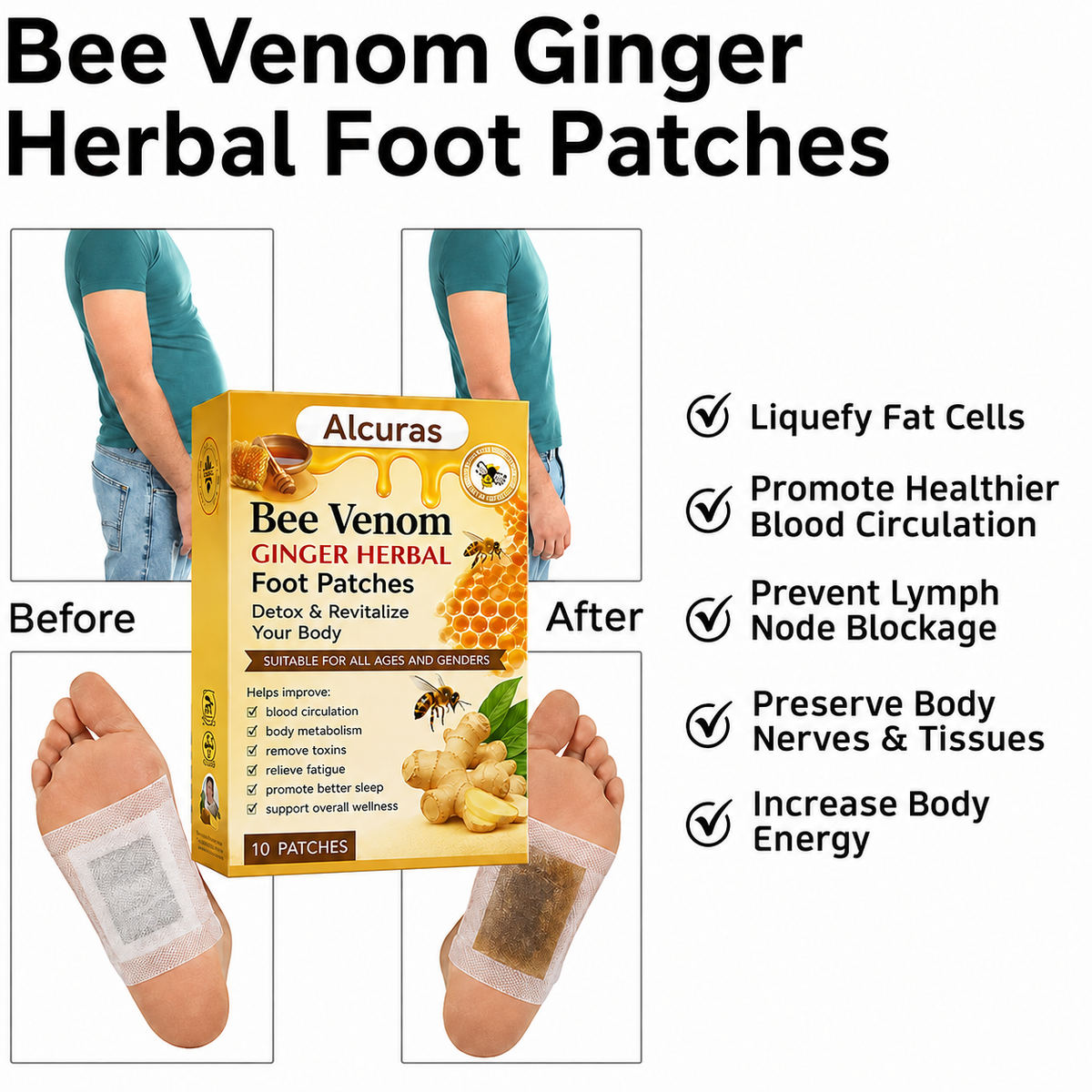Alcuras® Bee Venom Ginger Herbal Foot Patches (Set of 10)