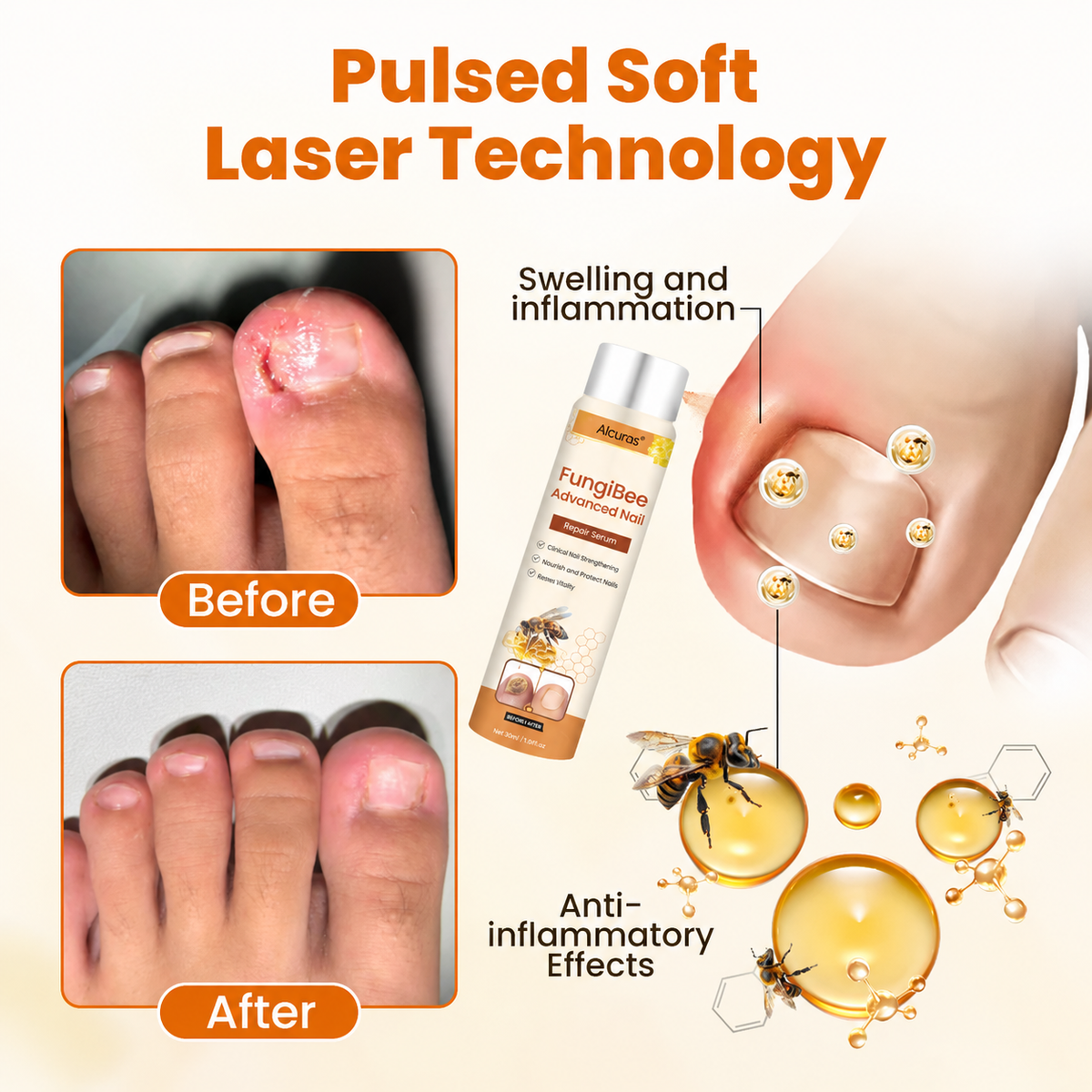 Alcuras® FungiBee Advanced Nail Repair Spray